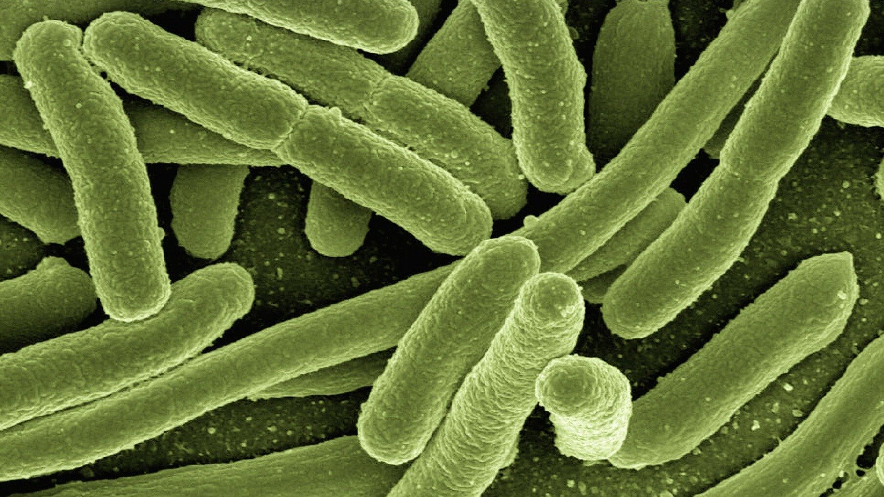 Harmless or deadly New study examines evolution of E. coli bacteria