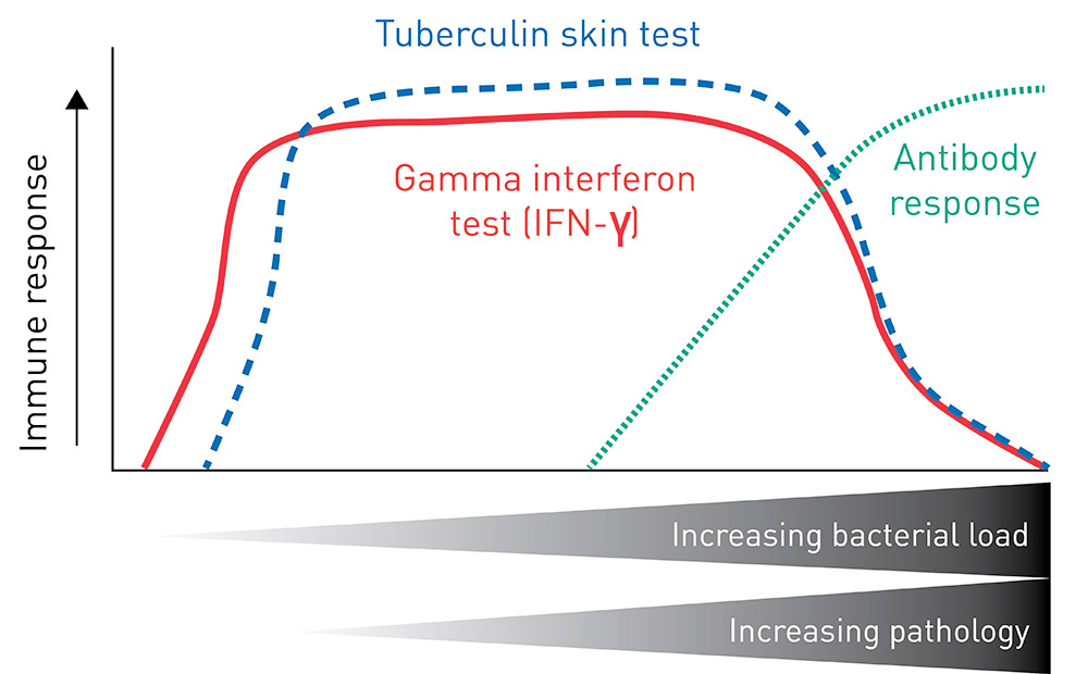 TB (Bovine Tuberculosis)